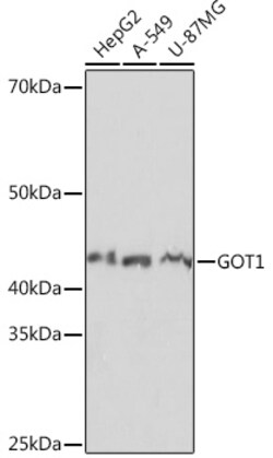 Invitrogen GOT1 Recombinant Rabbit Monoclonal Antibody (5J1B4) 100 &mu;L;