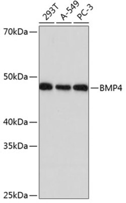 Invitrogen BMP4 Recombinant Rabbit Monoclonal Antibody (7Q2U7) 100 &mu;L | Buy Online | Invitrogen&trade; | Fisher Scientific