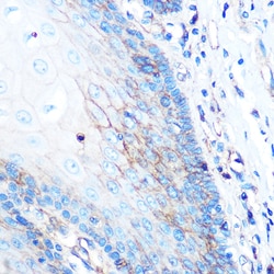 Invitrogen HLA-A Recombinant Rabbit Monoclonal Antibody (8L2H2) 100 &mu;L;