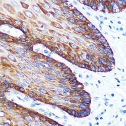 Invitrogen GM130 Recombinant Rabbit Monoclonal Antibody (2L3P6) 100 &mu;L;