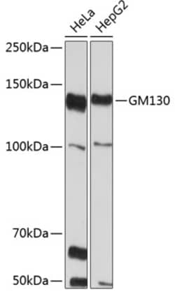 Invitrogen GM130 Recombinant Rabbit Monoclonal Antibody (2L3P6) 100 &mu;L;