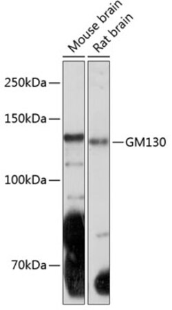 Invitrogen GM130 Recombinant Rabbit Monoclonal Antibody (2L3P6) 100 &mu;L;