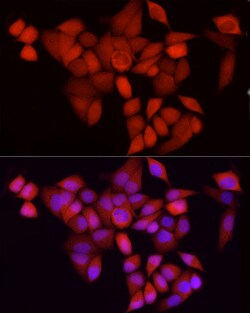 Invitrogen CDK1 Recombinant Rabbit Monoclonal Antibody (4Q9J8) 100 &mu;L;