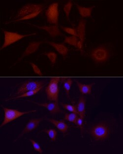 Invitrogen CDK1 Recombinant Rabbit Monoclonal Antibody (4Q9J8) 100 &mu;L;
