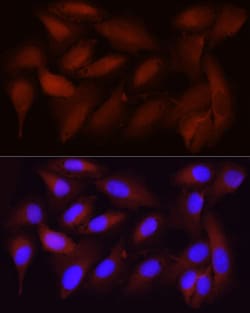Invitrogen CDK1 Recombinant Rabbit Monoclonal Antibody (4Q9J8) 100 &mu;L;