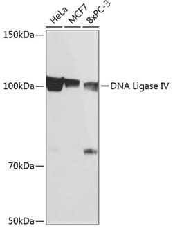 Invitrogen DNA Ligase IV Recombinant Rabbit Monoclonal Antibody (2T6J2)