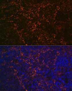 Invitrogen CD23 Recombinant Rabbit Monoclonal Antibody (9K9U5) 100 &mu;L;