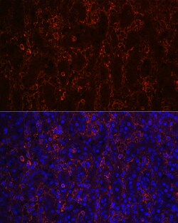 Invitrogen CD23 Recombinant Rabbit Monoclonal Antibody (9K9U5) 100 &mu;L;