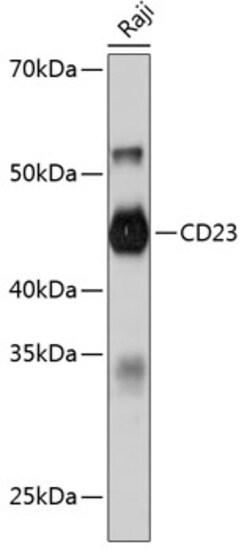 Invitrogen CD23 Recombinant Rabbit Monoclonal Antibody (9K9U5) 100 &mu;L;