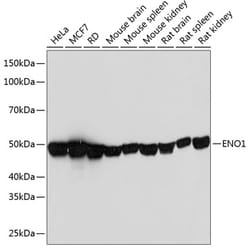 Invitrogen ENO1 Recombinant Rabbit Monoclonal Antibody (9E5R2) 100 &mu;L;
