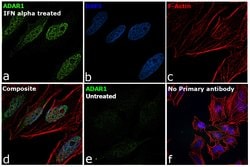 Invitrogen ADAR1 Recombinant Rabbit Monoclonal Antibody (7H1U2) 100 &mu;L;