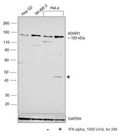 Invitrogen ADAR1 Recombinant Rabbit Monoclonal Antibody (7H1U2) 100 &mu;L;