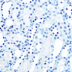 Invitrogen MAD2 Recombinant Rabbit Monoclonal Antibody (5W5U1) 100 &mu;L;