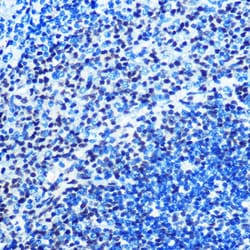 Invitrogen MAD2 Recombinant Rabbit Monoclonal Antibody (5W5U1) 100 &mu;L;