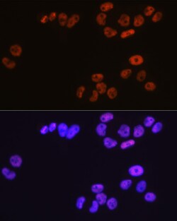 Invitrogen MCM3 Recombinant Rabbit Monoclonal Antibody (9Z5W4) 100 &mu;L;