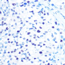 Invitrogen MCM3 Recombinant Rabbit Monoclonal Antibody (9Z5W4) 100 &mu;L;