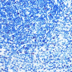 Invitrogen MCM3 Recombinant Rabbit Monoclonal Antibody (9Z5W4) 100 &mu;L;
