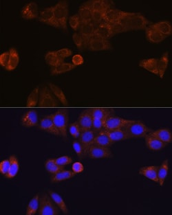 Invitrogen CES1 Recombinant Rabbit Monoclonal Antibody (7C9R6) 100 &mu;L;