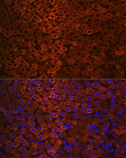 Invitrogen CES1 Recombinant Rabbit Monoclonal Antibody (7C9R6) 100 &mu;L;