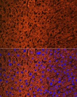 Invitrogen CES1 Recombinant Rabbit Monoclonal Antibody (7C9R6) 100 &mu;L;