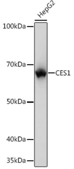 Invitrogen CES1 Recombinant Rabbit Monoclonal Antibody (7C9R6) 100 &mu;L;