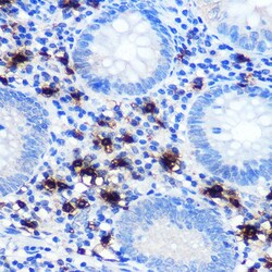 Invitrogen Mast Cell Chymase Recombinant Rabbit Monoclonal Antibody (2O4P8)