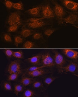 Invitrogen ARF6 Recombinant Rabbit Monoclonal Antibody (9E7T9) 100 &mu;L;