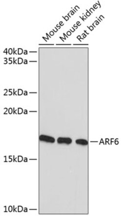 Invitrogen ARF6 Recombinant Rabbit Monoclonal Antibody (9E7T9) 100 &mu;L;