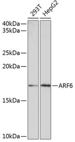 Invitrogen ARF6 Recombinant Rabbit Monoclonal Antibody (9E7T9) 100 &mu;L;