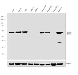 Invitrogen ALDH2 Recombinant Rabbit Monoclonal Antibody (1J9I8) 100 &mu;L;