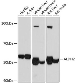 Invitrogen ALDH2 Recombinant Rabbit Monoclonal Antibody (1J9I8) 100 &mu;L;