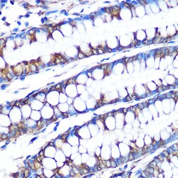 Invitrogen LOX Recombinant Rabbit Monoclonal Antibody (9K10Z3) 100 &mu;L;