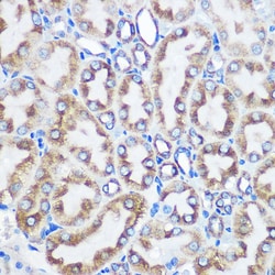 Invitrogen LOX Recombinant Rabbit Monoclonal Antibody (9K10Z3) 100 &mu;L;
