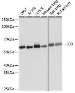 Invitrogen LOX Recombinant Rabbit Monoclonal Antibody (9K10Z3) 100 &mu;L;