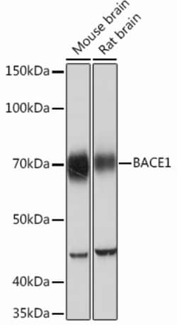 Invitrogen BACE1 Recombinant Rabbit Monoclonal Antibody (7C5T7) 100 &mu;L | Buy Online | Invitrogen&trade; | Fisher Scientific
