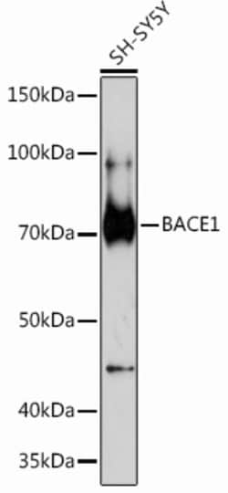 Invitrogen BACE1 Recombinant Rabbit Monoclonal Antibody (7C5T7) 100 &mu;L | Buy Online | Invitrogen&trade; | Fisher Scientific