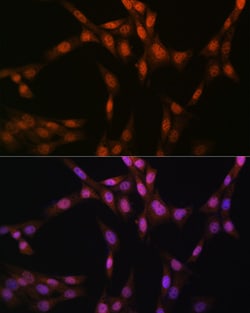 Invitrogen GSS Recombinant Rabbit Monoclonal Antibody (2S9W7) 100 &mu;L;