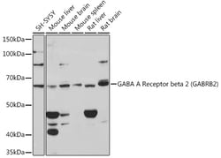 Invitrogen GABRB2 Recombinant Rabbit Monoclonal Antibody (6G9O8) 100 &mu;L;