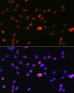 Invitrogen hnRNP A1 Recombinant Rabbit Monoclonal Antibody (10N0F4) 100
