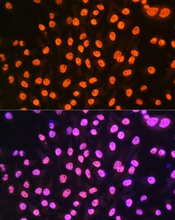 Invitrogen hnRNP A1 Recombinant Rabbit Monoclonal Antibody (10N0F4) 100