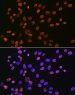 Invitrogen hnRNP A1 Recombinant Rabbit Monoclonal Antibody (10N0F4) 100