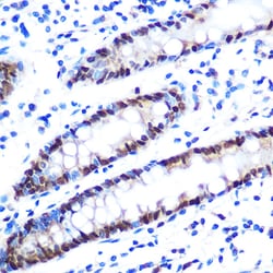 Invitrogen hnRNP A1 Recombinant Rabbit Monoclonal Antibody (10N0F4) 100