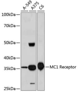 Invitrogen MC1R Recombinant Rabbit Monoclonal Antibody (6D1S5) 100 &mu;L | Buy Online | Invitrogen&trade; | Fisher Scientific