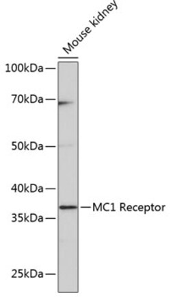 Invitrogen MC1R Recombinant Rabbit Monoclonal Antibody (6D1S5) 100 &mu;L | Buy Online | Invitrogen&trade; | Fisher Scientific