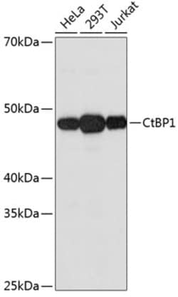 Invitrogen CtBP1 Recombinant Rabbit Monoclonal Antibody (1I7G6) 100 &mu;L;