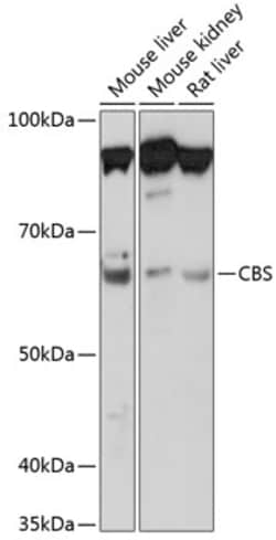 Invitrogen CBS Recombinant Rabbit Monoclonal Antibody (1R2E9) 100 &mu;L;