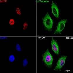 Invitrogen MiTF Recombinant Rabbit Monoclonal Antibody (9P1O1) 100 &mu;L;