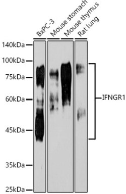 Invitrogen IFNGR1 Recombinant Rabbit Monoclonal Antibody (2B9Q1) 100 &mu;L;