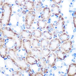 Invitrogen RHAMM Recombinant Rabbit Monoclonal Antibody (3L10H9) 100 &mu;L;