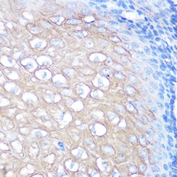 Invitrogen RHAMM Recombinant Rabbit Monoclonal Antibody (3L10H9) 100 &mu;L;